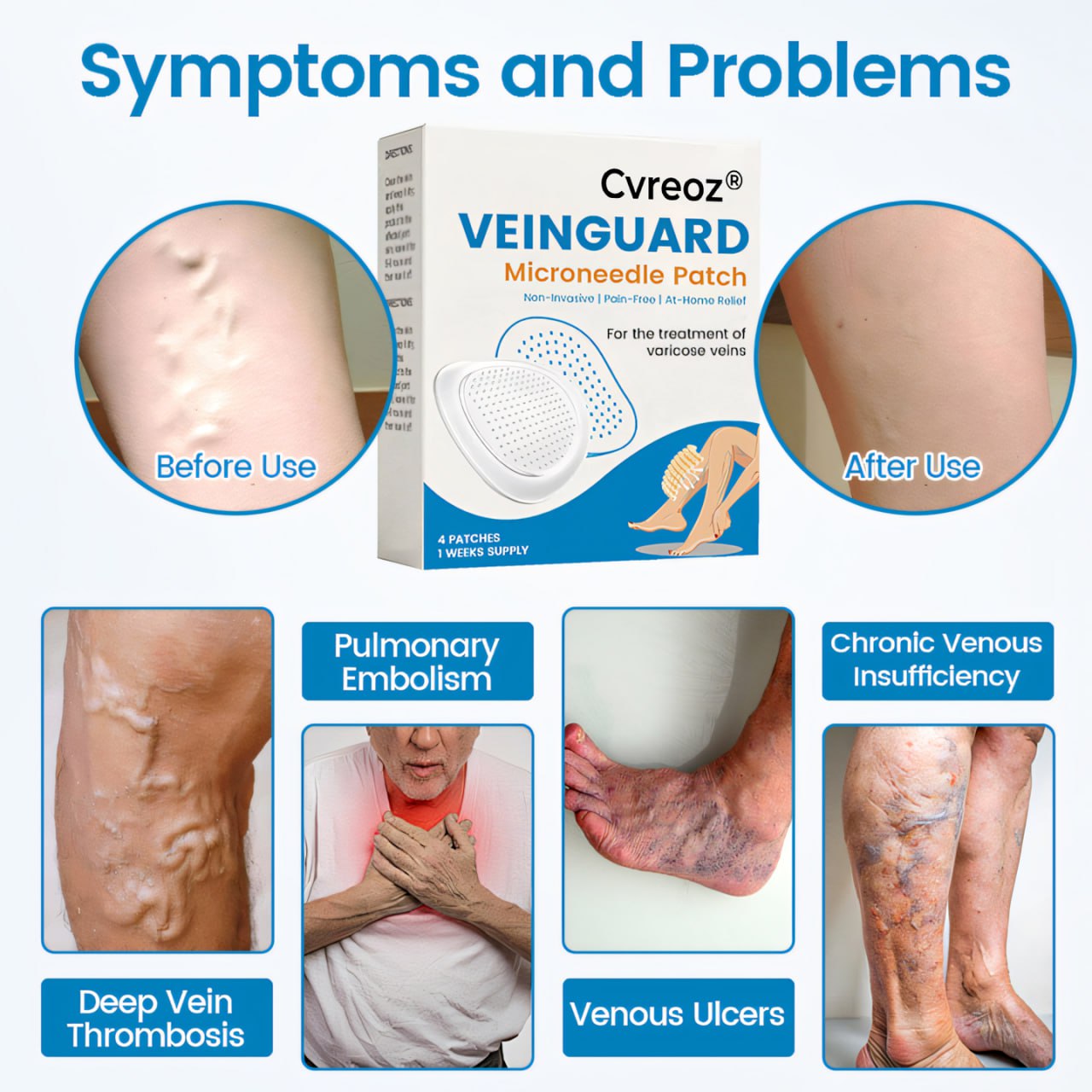Cvreoz® VeinGuard Microneedle Patch