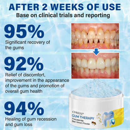 CVREOZ® Gum Therapy Focussmile Bee Venom Powder 🔬 Clinically Trusted by Dentists 🦷