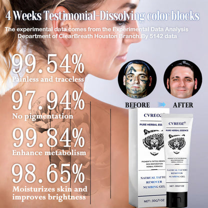 💖Limited Offer 60% OFF - Crveoz® Natural Tattoo Removal Numbing Gel
