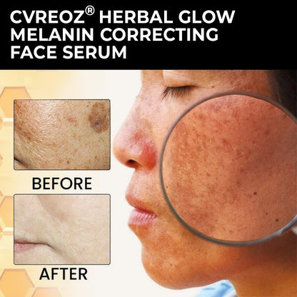 🔥LIMITED TIME OFFER 60% OFF!  🔥 Crveoz® Herbal Glow Melanin Correcting Face Serum
