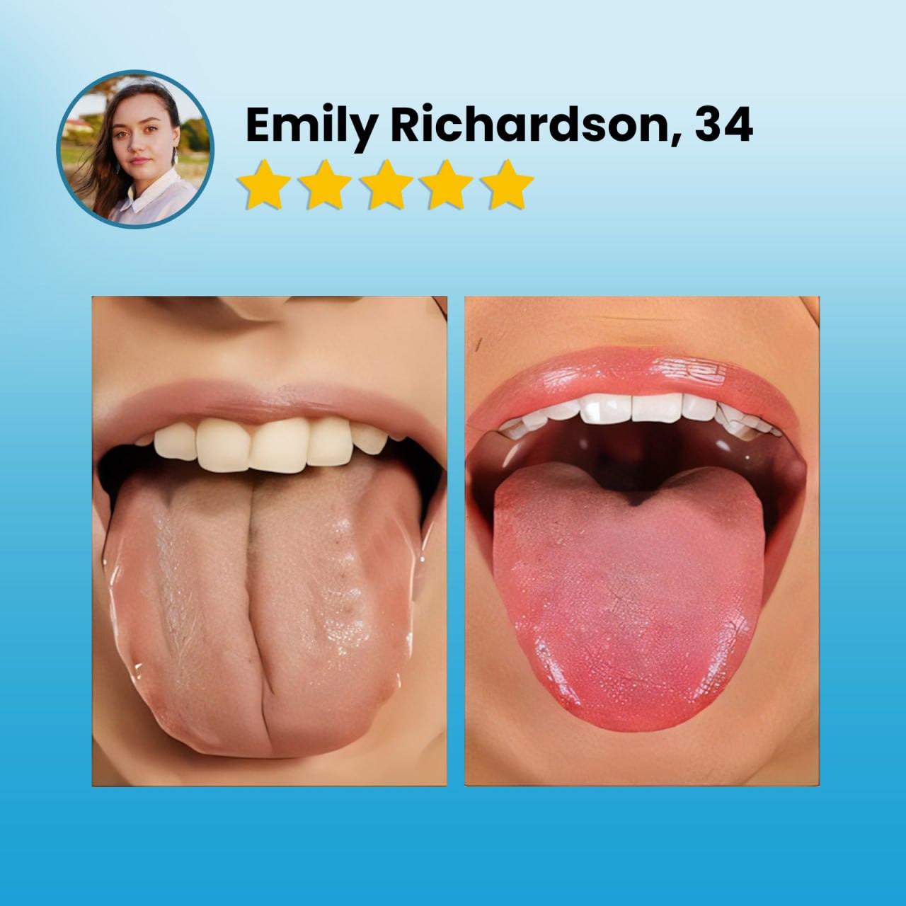 CVREOZ®Tongue Coating Cleaning Gel