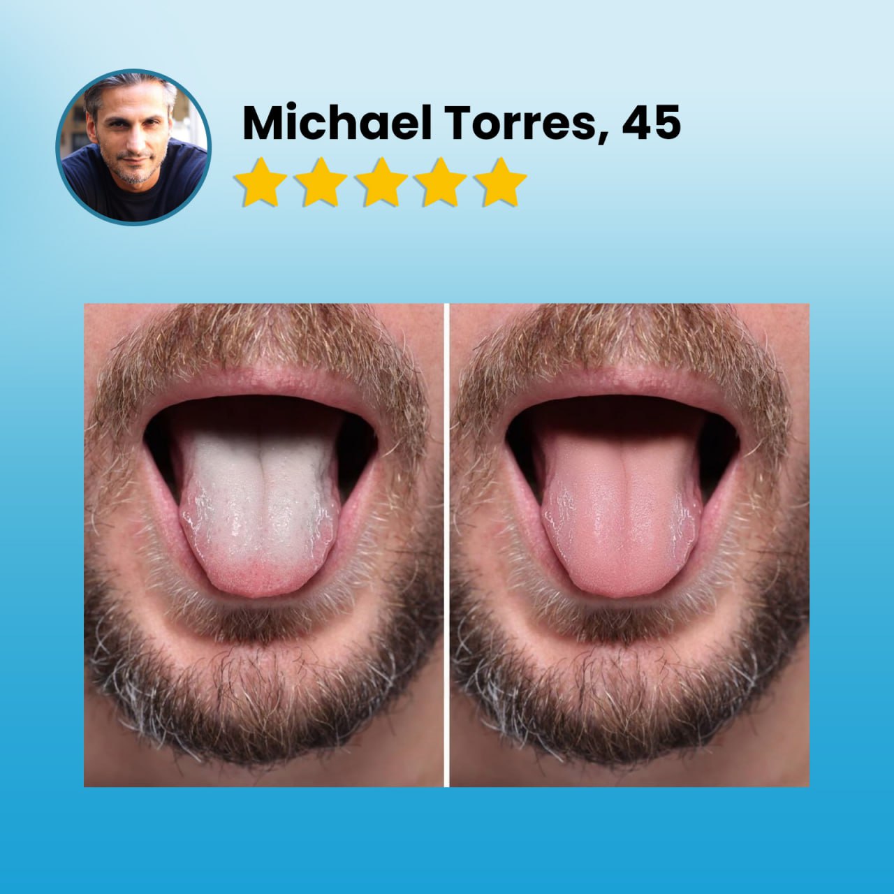 CVREOZ®Tongue Coating Cleaning Gel