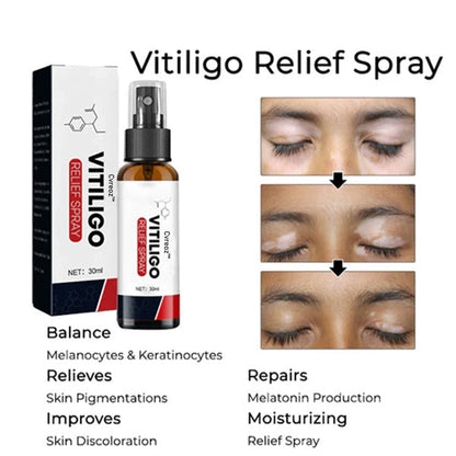 Cvreoz™ Vitiligo Relief Spray ⏰ Hurry Up - Final Day to Save 70%! 💥