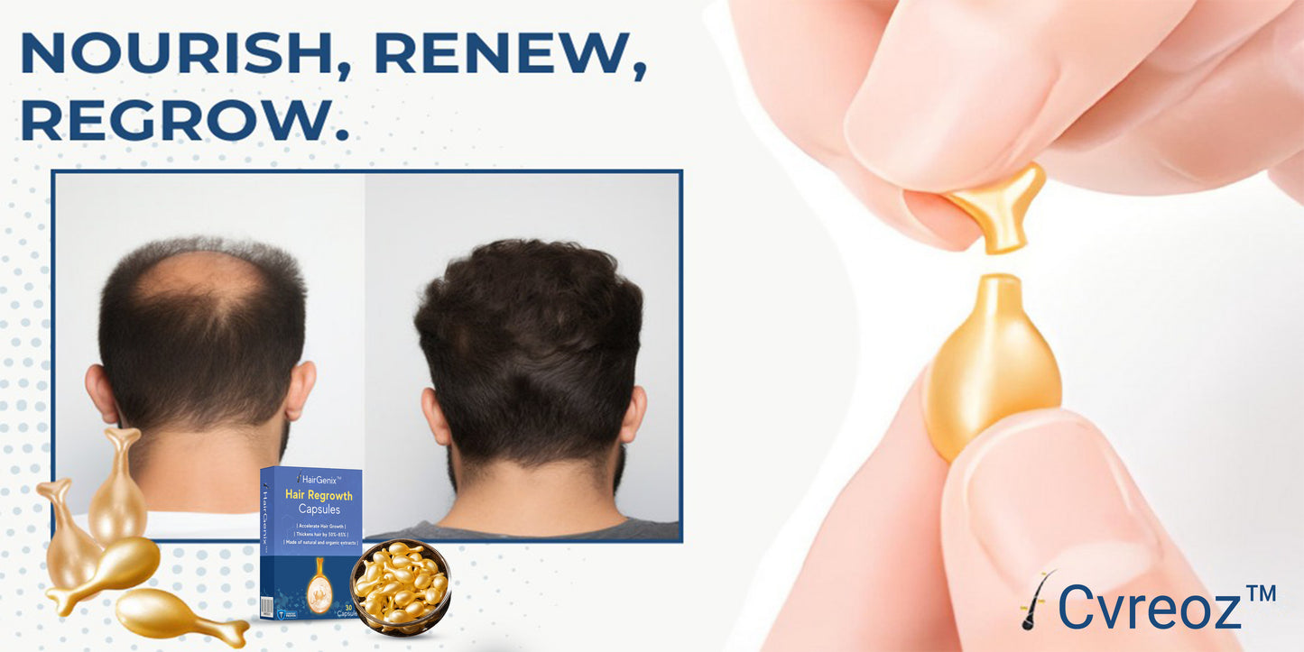 Cvreoz™ Hair Regrowth Capsules ⭐Grab your 70% DISCOUNTS today! ⏳🎁