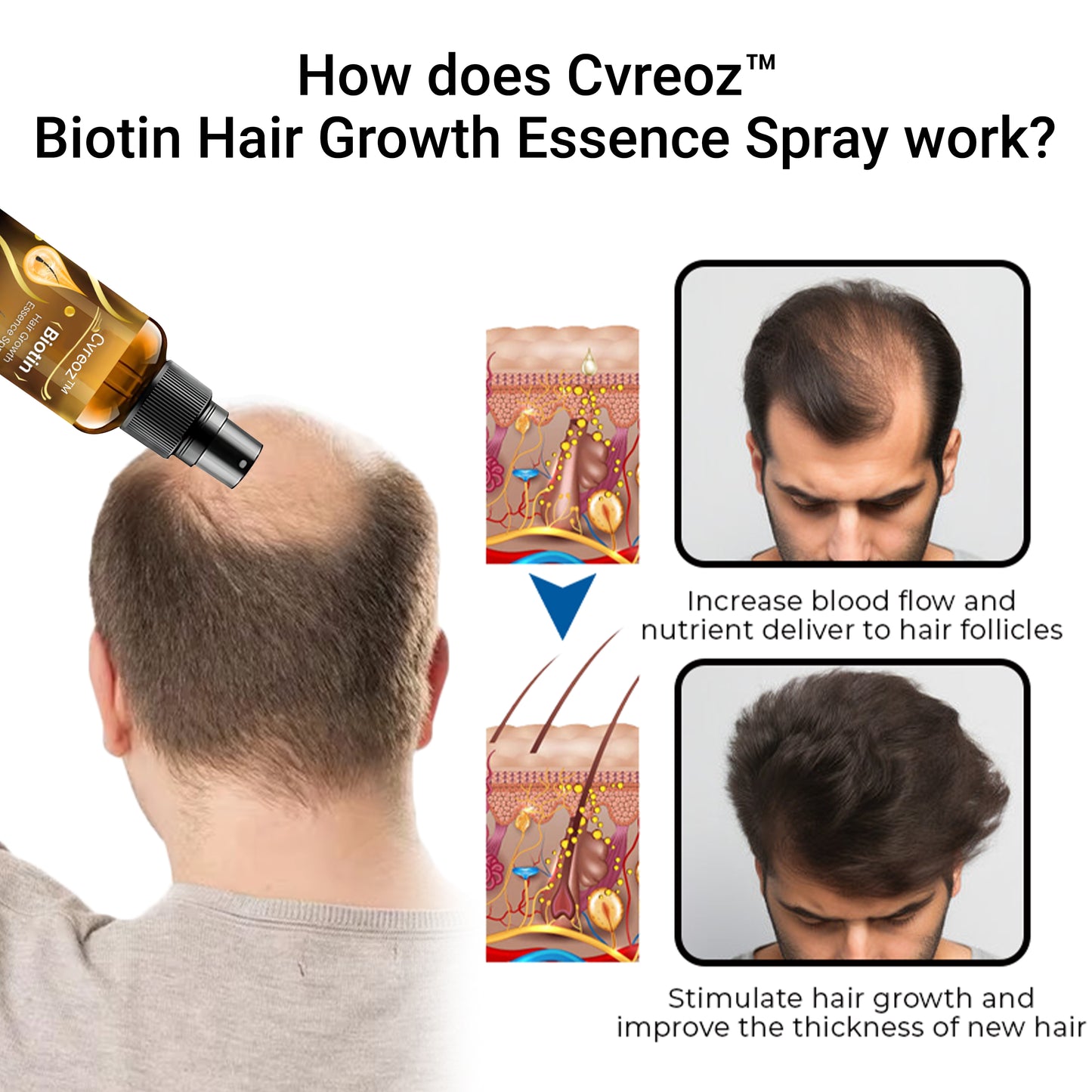 Cvreoz™ Biotin Hair Growth Essence Spray 🚨 Last Chance—Ends in 10 Minutes! 🚨⏰